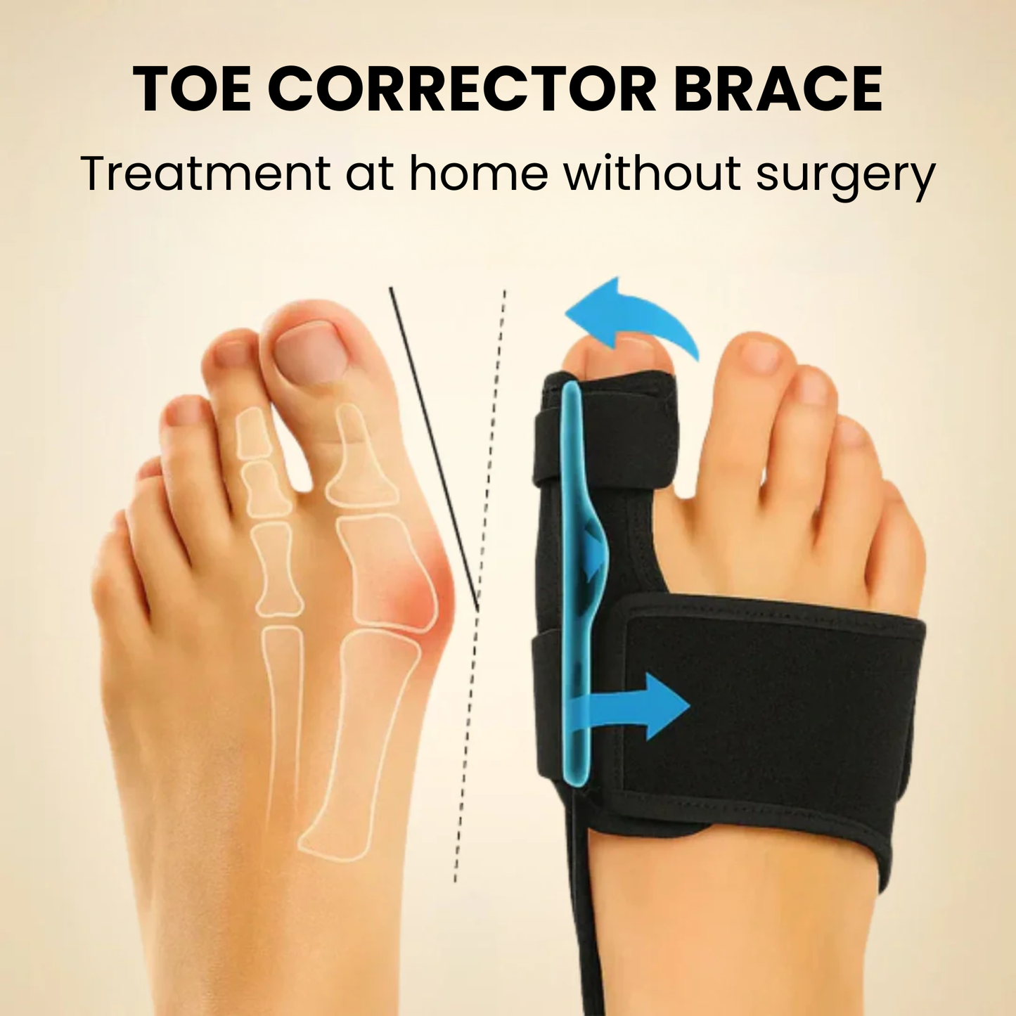 Toe Corrector Brace