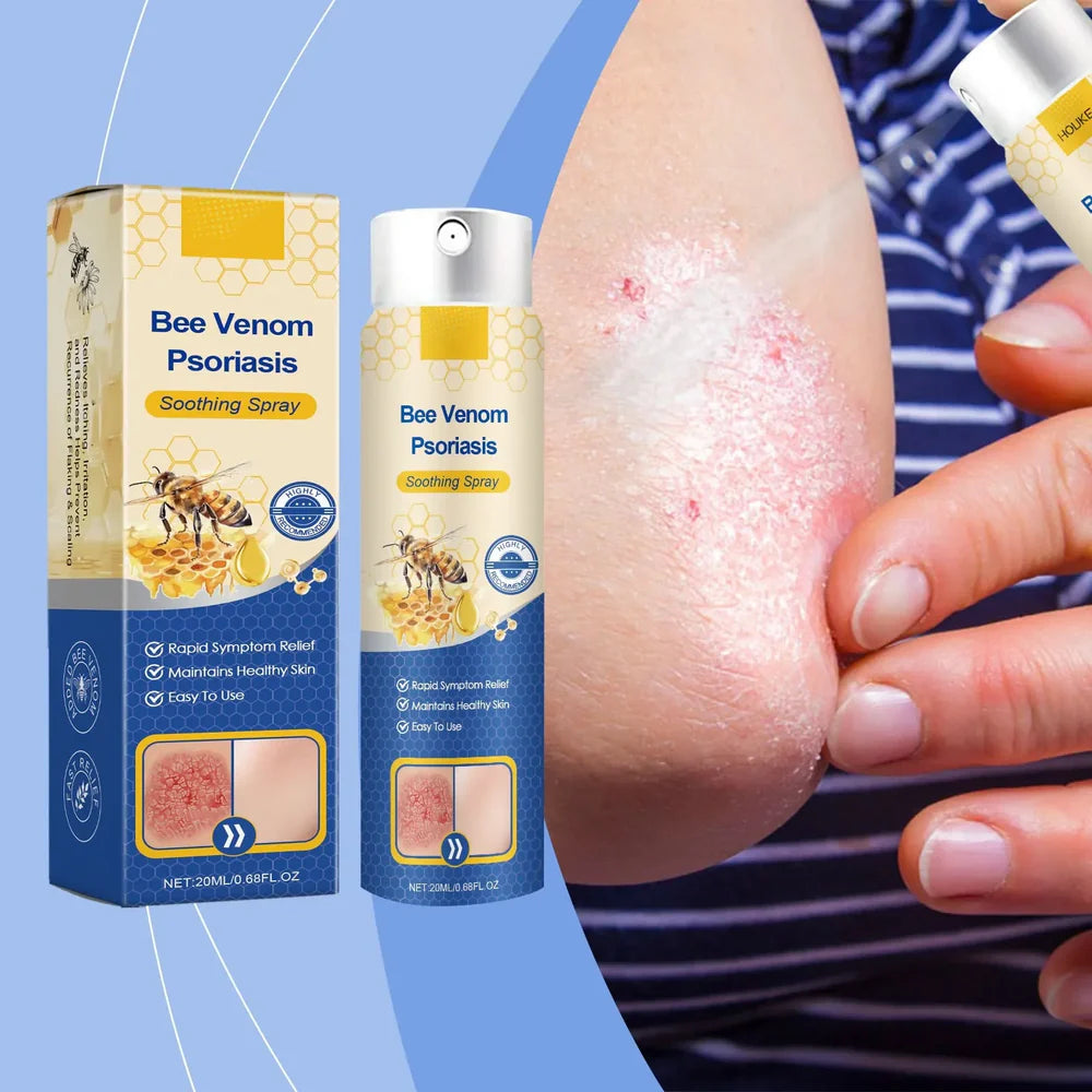 Bee Venom Psoriasis Spray | Soothe itchy skin quickly